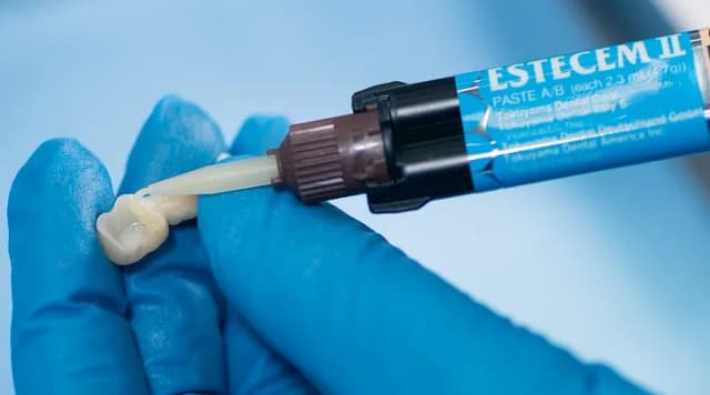 Ile schnie cement dentystyczny? Poznaj czasy schnięcia i czynniki wpływające Ile schnie cement dentystyczny? Poznaj czasy schnięcia i czynniki wpływające